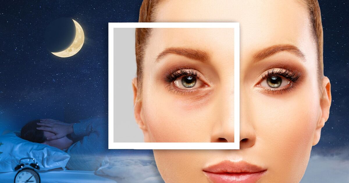 Las ojeras y bolsas en los ojos pueden aparecer por falta de sueño y otros factores. (Foto: Especial El Financiero)