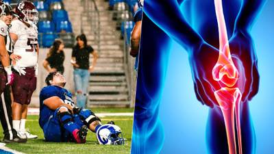 ¿Qué es el valgo de rodilla forzado, lesión que provocó Osvaldo Canchola del IPN a Diogo Zanchet?