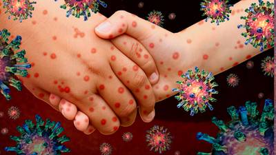 El COVID-19 no es el único virus al ‘acecho’: OPS alerta por rebrotes de sarampión