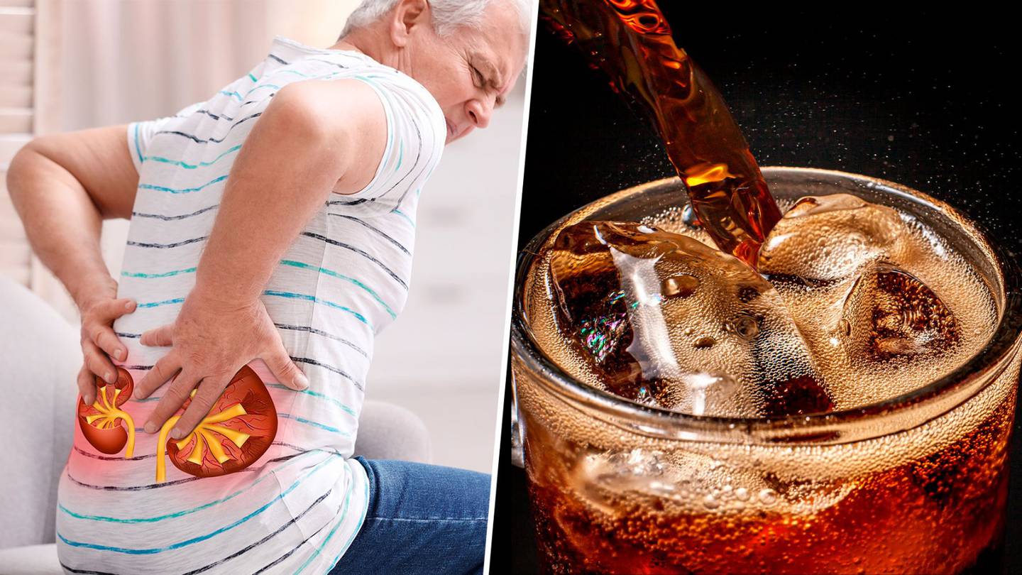 He Drinks Phosphoric Acid, A Substance In Cola, Which Damages The Kidneys And Kidney Tubes