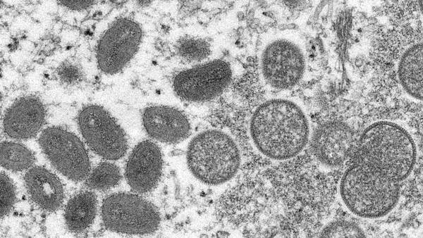 Ya, por favor: China detecta 35 casos de henipavirus, un nuevo virus de origen animal