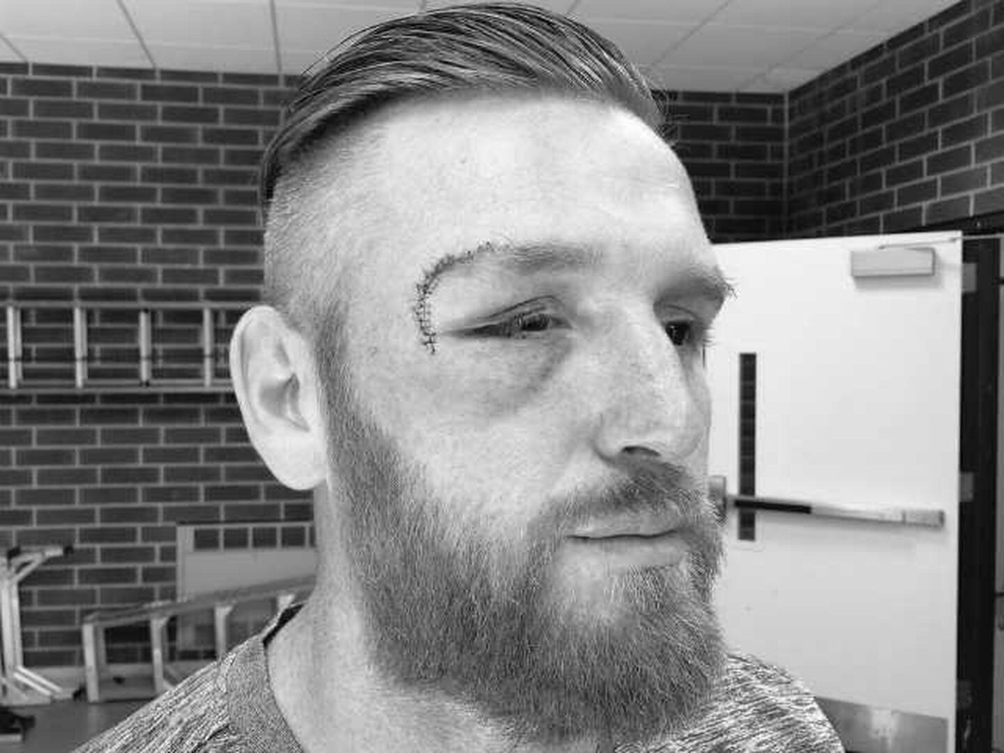 WWE: Heath Slater salvó su ojo derecho de milagro