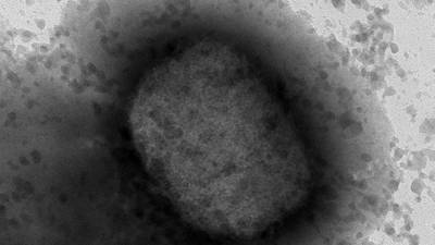 Viruela de mono: Investigadores de España obtienen la primera secuencia completa del virus