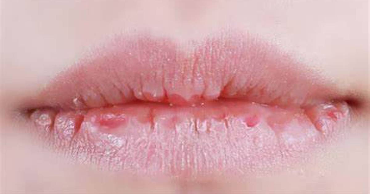 Dlaczego suchość w ustach jest związana z wirusem Corona?  – Finanse