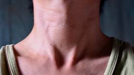 ¿Por qué el hipotiroidismo afecta tanto a las mujeres?