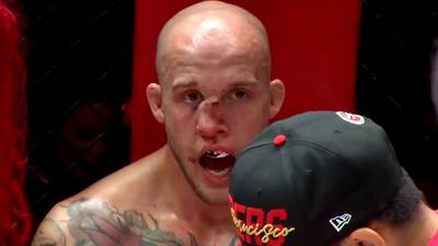¡Qué dolor! La aparatosa fractura de nariz en el A1 Combat Series de MMA (VIDEO)