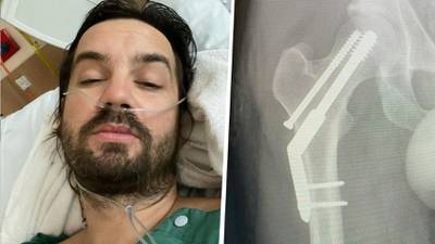 Kevin Parker, líder de Tame Impala, se fractura la cadera; ¿Cancela sus conciertos en México?