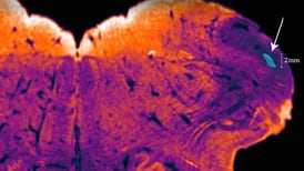 Neurocientíficos descubren una parte oculta en el cerebro