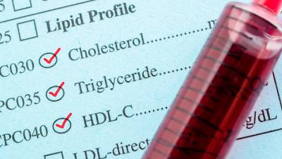 Niveles altos de triglicéridos: ¿Cuáles son las causas y los síntomas?