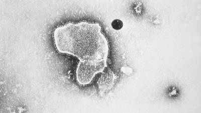 Virus sincitial: ¿Cómo podrían las madres proteger a sus bebés de esta enfermedad?