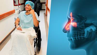 Síntomas de sinusitis crónica: Eduin Caz habla desde el hospital tras su última cirugía