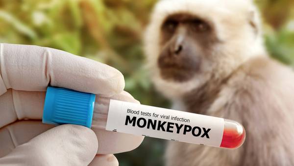 Viruela del mono: Esta es la principal vía de contagio, según estudio 