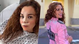 Reconstruyen la nariz de Mayte Carranco tras fuerte caída durante reality show