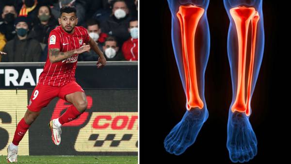 ¿Qué es la rotura de peroné y ligamentos, lesión que sufrió ‘Tecatito’ rumbo a Qatar 2022?
