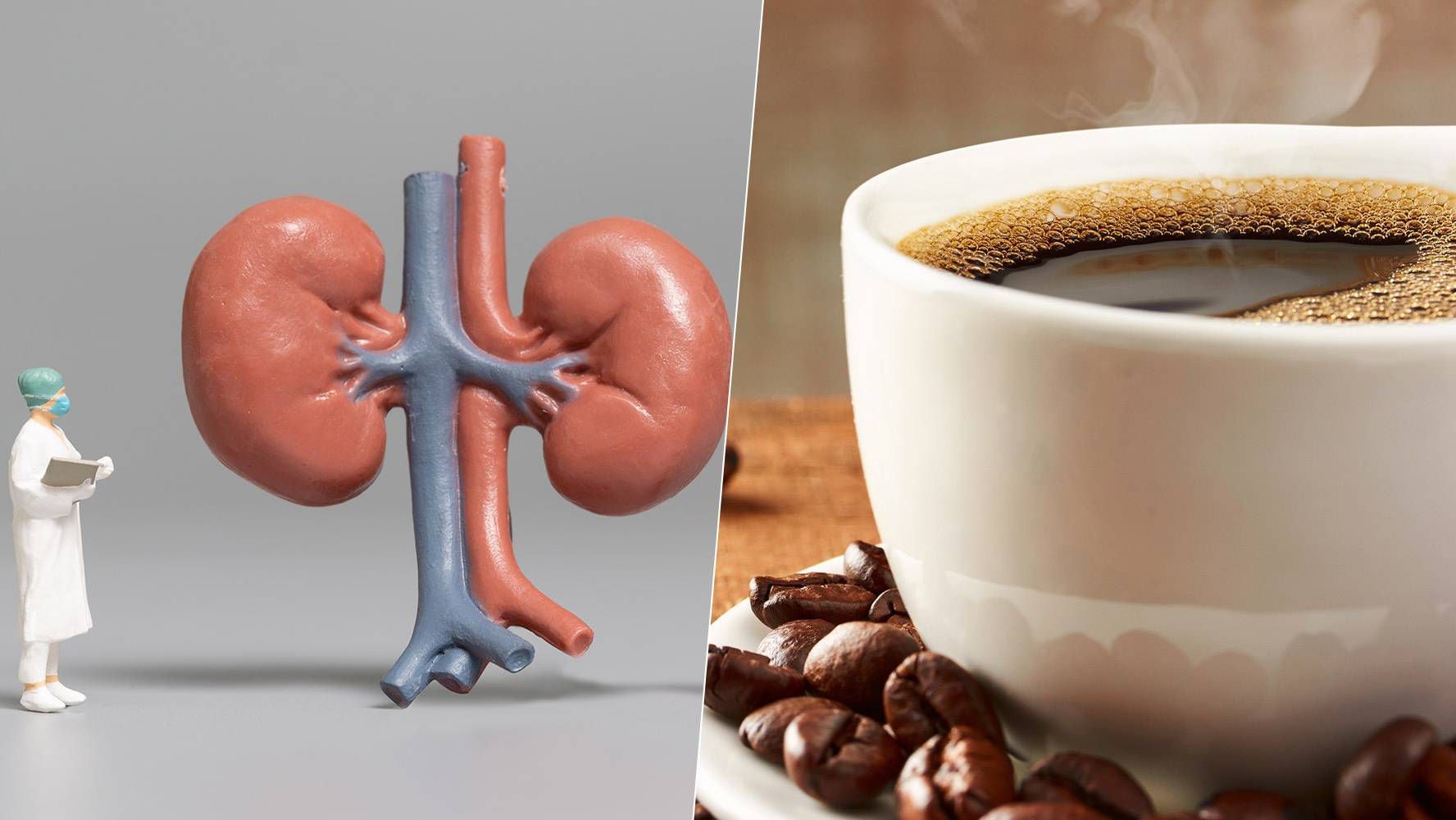 Cómo afecta el café a la salud de tus riñones? – El Financiero