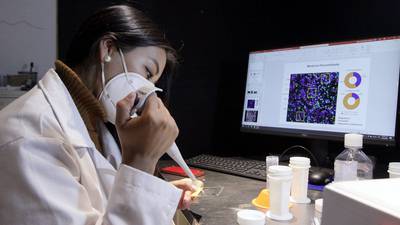 Registro Nacional de Gemelos: UNAM emprende proyecto para identificar el peso genético en enfermedades