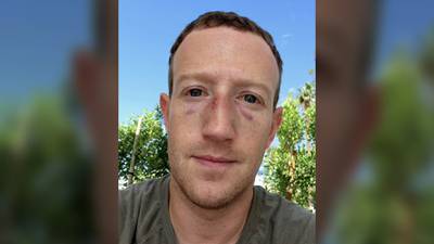 Como ‘santo Cristo’: Mark Zuckerberg aparece con el rostro golpeado, ¿qué le ocurrió?