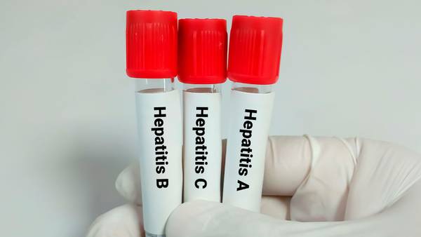 ¿Cómo se contagian los 5 diferentes tipos de hepatitis? 