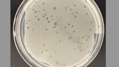 Resistencia a antibióticos: ¿Qué son los virus depredadores que combaten bacterias?