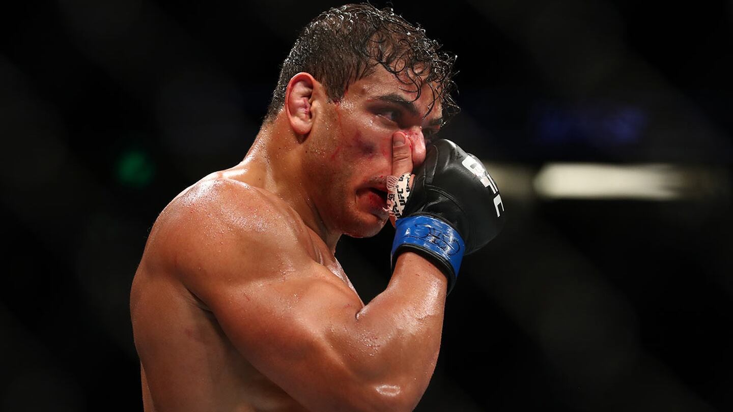 Paulo Costa donará su cerebro para estudiar impacto de golpes en MMA