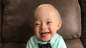 La nueva imagen de Gerber es un bebé con síndrome de Down
