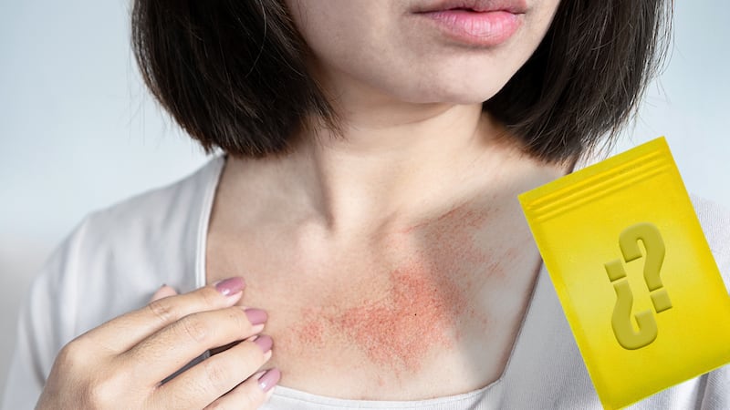 ¿El calorón te pone ‘roñoso’? 7 tips para tratar el sarpullido o miliaria por altas temperaturas