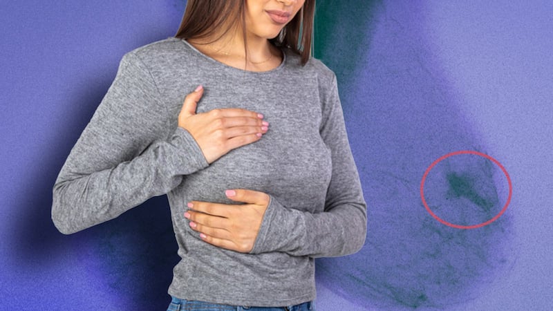 ¿Se puede reducir el riesgo padecer cáncer de mama?: 8 acciones clave para ‘alejarte’ de la enfermedad