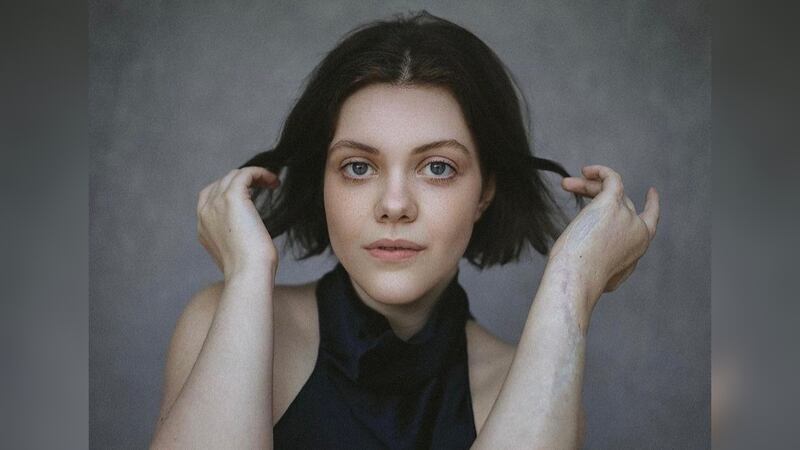 ¿Qué es la fascitis necrosante, enfermedad que sufrió actriz de ‘Las Crónicas de Narnia’?