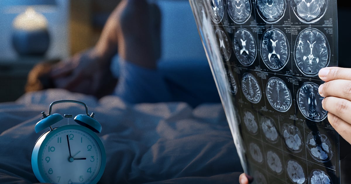 Dormir Poco: Riesgo Alzheimer, Depresión y Ansiedad