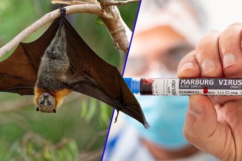 Virus de Marburgo: ¿En qué consiste el peligroso virus que acumula muertes en Guinea Ecuatorial?