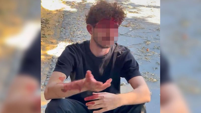 ¿Qué sabemos del joven italiano que fue golpeado durante funeral del ‘Mencho’?