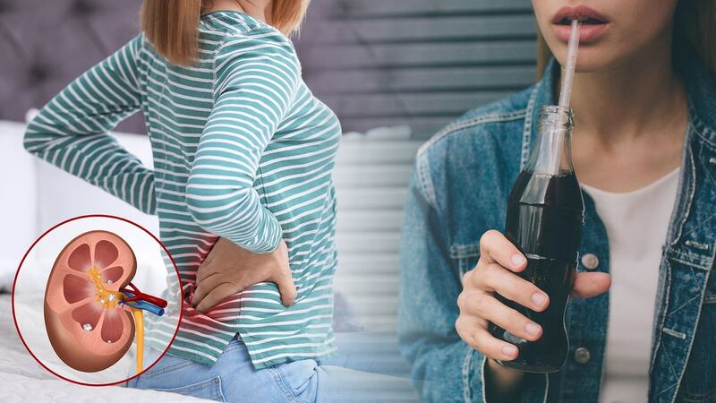 ¿Qué bebidas causan piedras en los riñones?