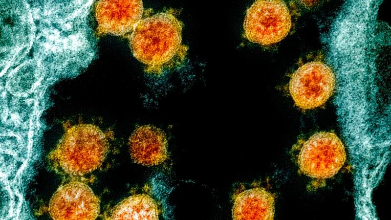 El ‘Santo Grial’ del COVID: Esta es la ‘fórmula’ para adquirir inmunidad, según estudio