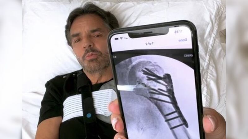 Reaparece Eugenio Derbez y explica cómo fue su accidente: ‘Se me salió un hueso’