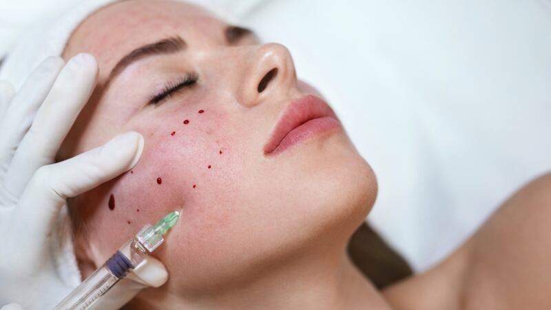 Facial ‘vampiro’ habría contagiado de VIH a 3 mujeres en EU. Esto sabemos