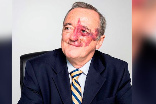 Mariano Barbacid: ¿Quién es el oncólogo español que habría encontrado la cura al cáncer de páncreas?