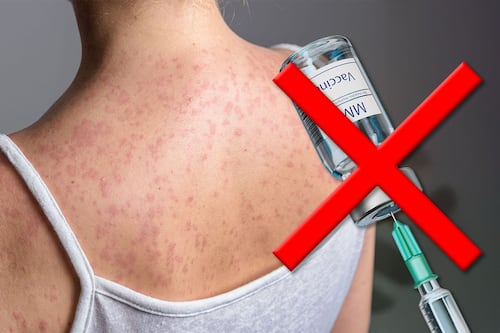 Brote de sarampión en México: ¿Cuáles son los riesgos de no vacunarse?