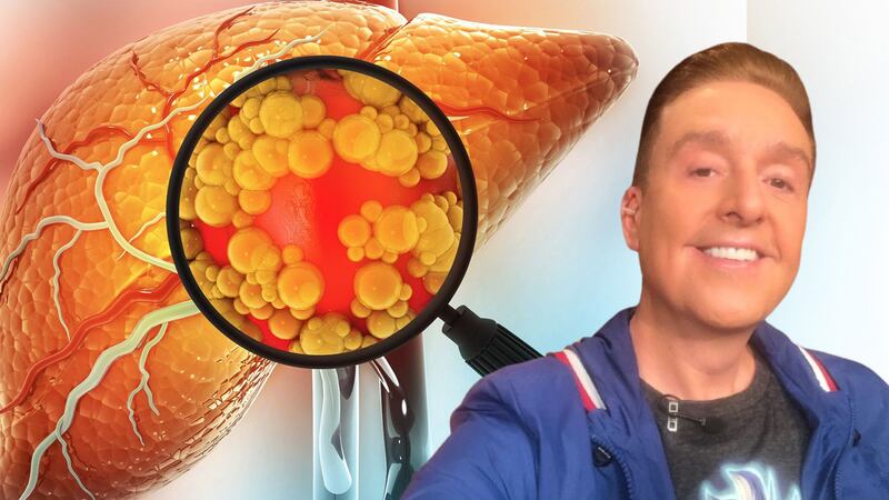 ¿Qué causa el hígado graso, padecimiento de Daniel Bisogno que lo llevó a requerir trasplante?