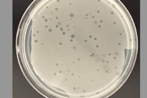 Resistencia a antibióticos: ¿Qué son los virus depredadores que combaten bacterias?