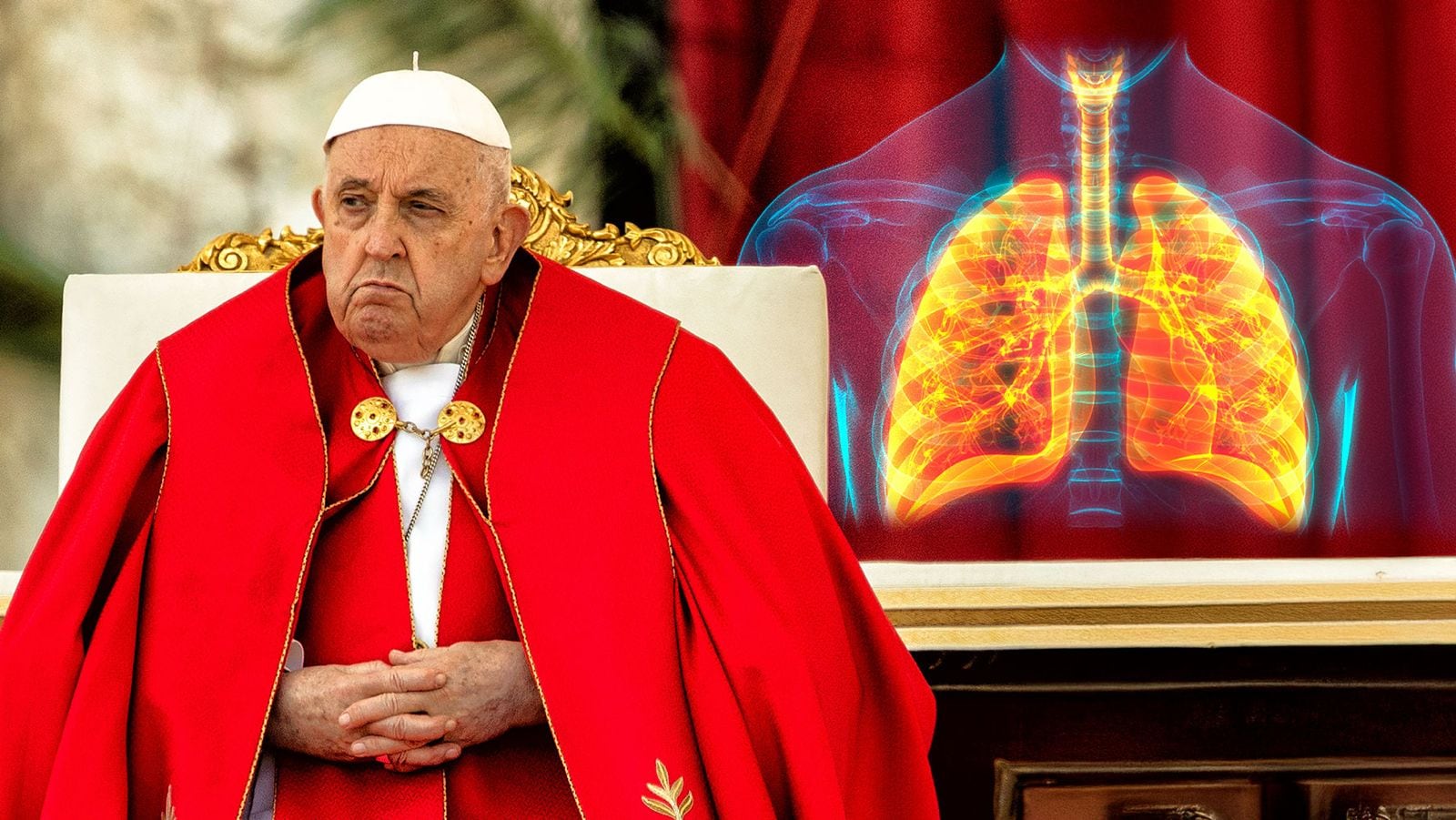 Salud del Papa Francisco: ¿Qué es la neumonía bilateral y cuáles son los síntomas? – El Financiero