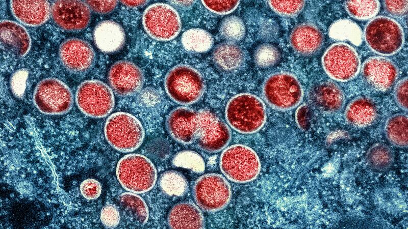 Suecia detecta el primer caso de viruela del mono fuera de África: ‘Es algo que tomamos en serio’