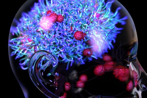 Resolvamos dudas: ¿el COVID puede desencadenar el síndrome de Guillain-Barré?