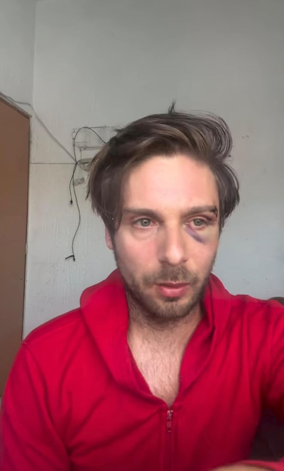 Joan Kuri explicó lo sucedido durante y posterior a ser víctima de agresión. (Foto: Captura)
