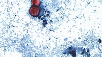 Cyclospora: mueren dos personas a causa del brote de diarrea explosiva en EU