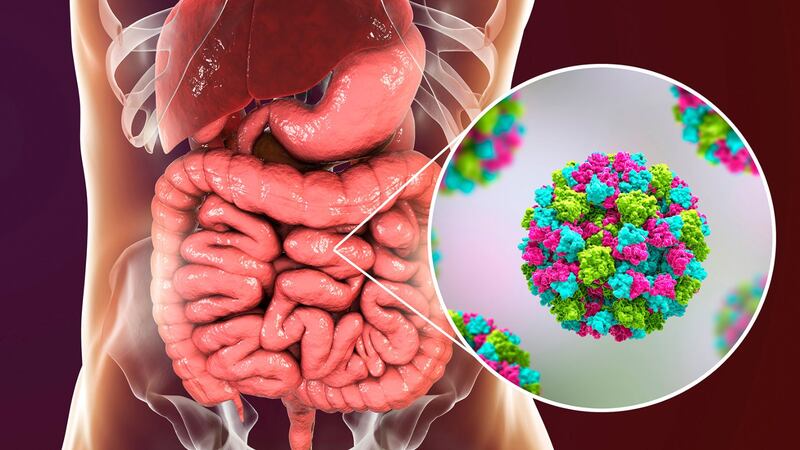 Norovirus o gripe estomacal ¿Cuánto duran los síntomas y cuáles son?