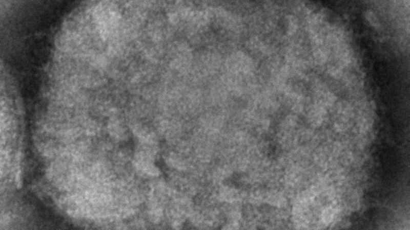 Viruela del mono no será pandemia, aunque aún hay muchas incógnitas: OMS