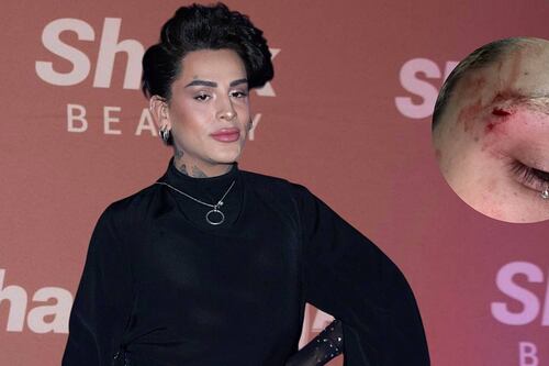 Influencer Kunno denuncia que lo golpearon al salir de un antro: ‘Me abrieron la ceja’