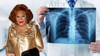 Luis Enrique Guzmán informó que Silvia Pinal tuvo un colapso pulmonar. (Foto: Especial El Financiero)