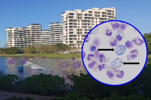 ‘Ameba comecerebros’ en México: Confirman su presencia en lago artificial de Plaza La Isla Mérida