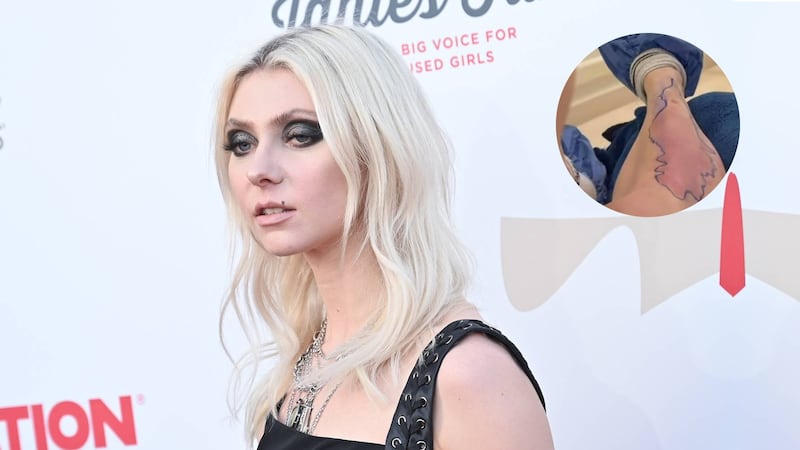‘El show debe continuar’: Hospitalizan a Taylor Momsen por picadura de araña antes de concierto con AC/DC
